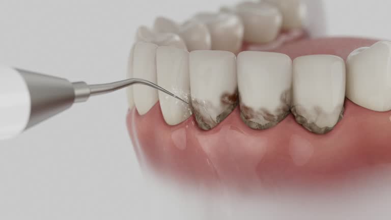 Reliable Dental Implants contractor in Parma, ID by Smile Center Dentistry
